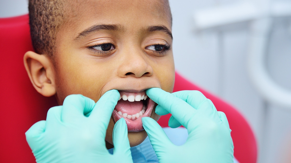 Early Dental Care decorative image