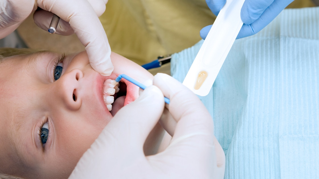 Child Receiving Fluoride Treatment