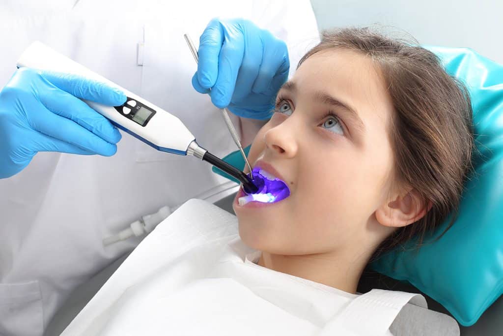 What Are Dental Sealants? Does Your Child Need Them?